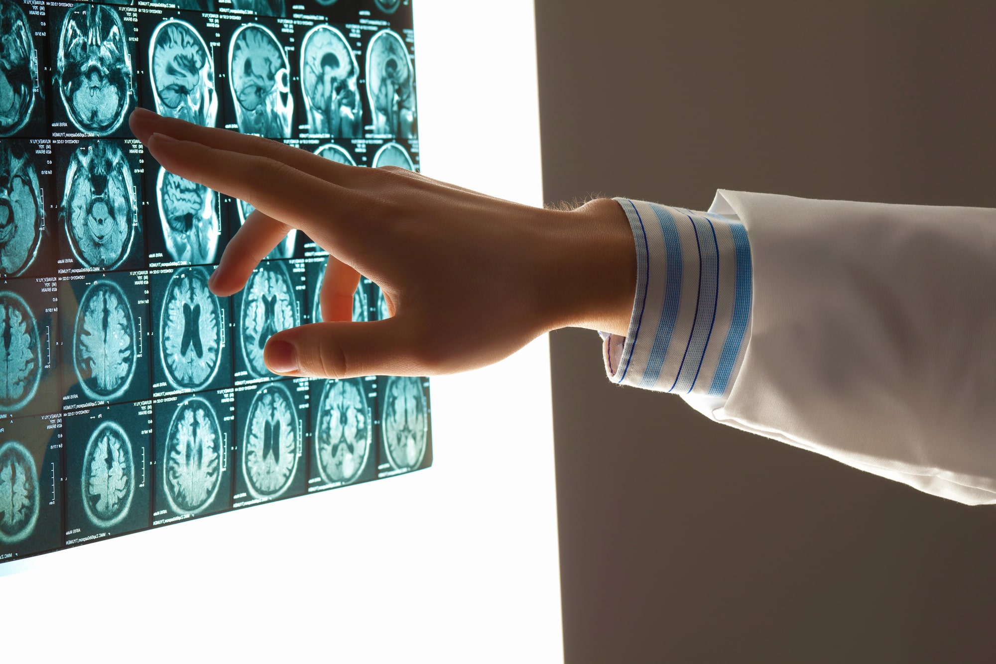 Catastrophic injury lawyer in Stafford, TX