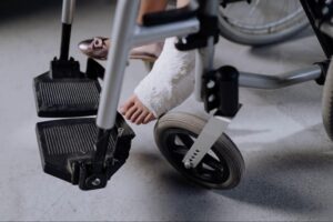 Close-up of a person's casted foot resting near a wheelchair's footrest and wheel, relevant to whether auto accident settlements are taxable when they cover long-term injury recovery